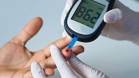 Representative image