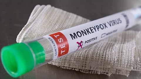 Representative Image