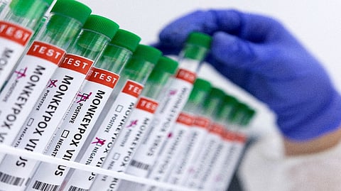 Representative image