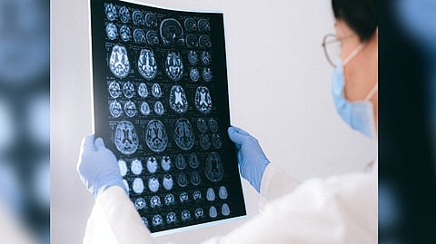 Representative image