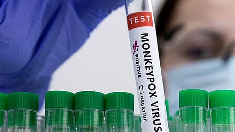 Indonesia confirms first monkeypox case - health ministry