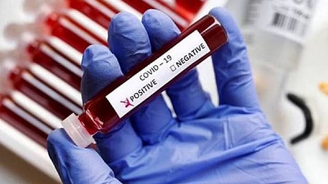 Representative image