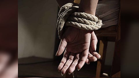 Representative image