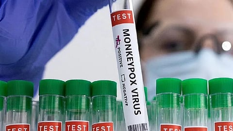 Representative image