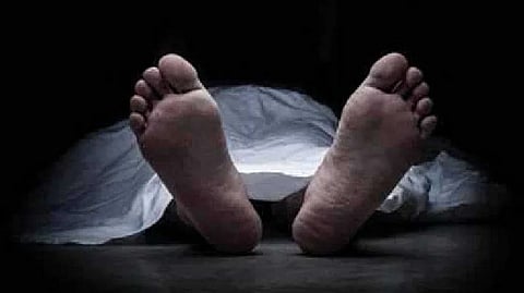 Representative image