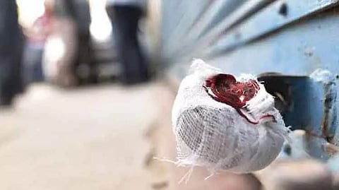 Representative image