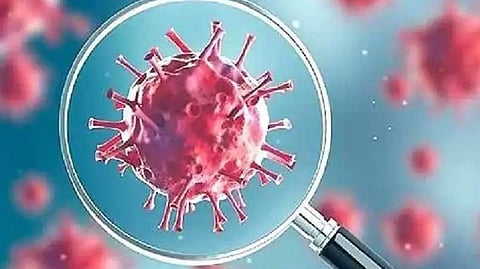 Representative image