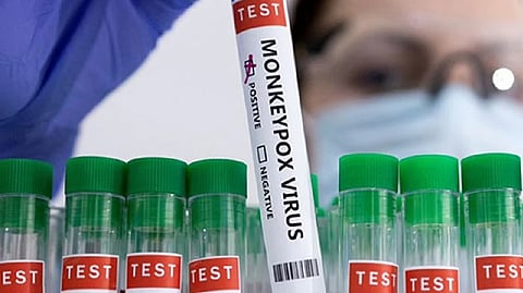 Representative image