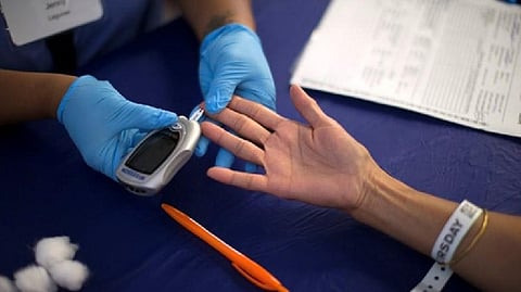 Representative Image