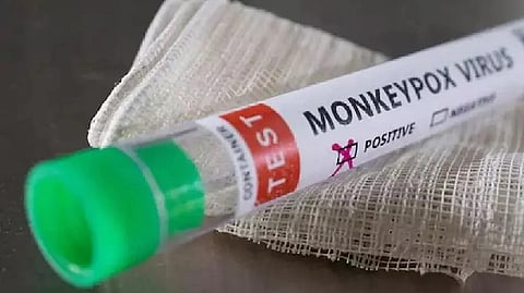 Representative image