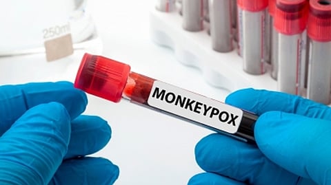 Representative image