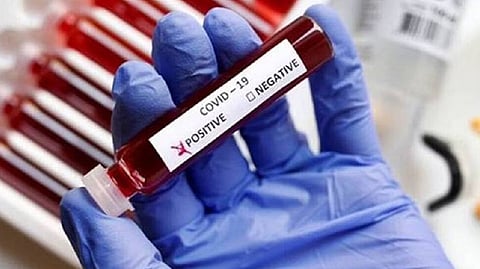 Representative image