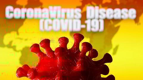 Representative Image