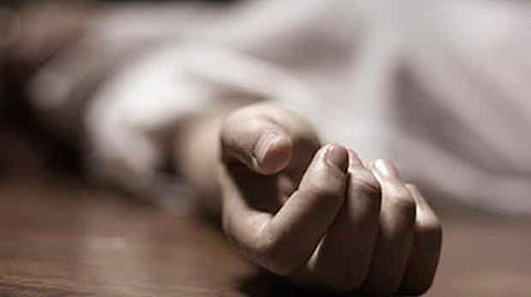 Representative image