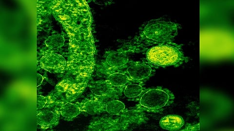 Representative Image