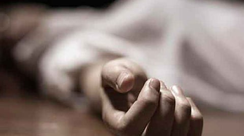 Representative image