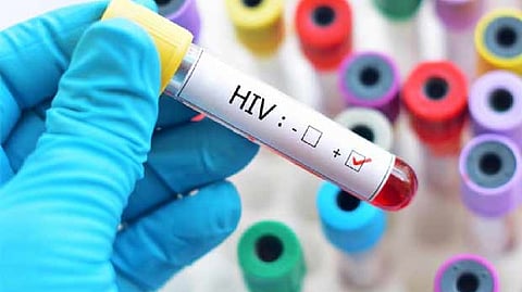 Representative image