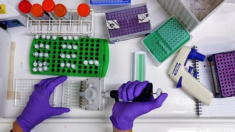 Representative image