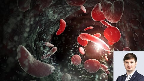 DT Health: Debunking blood stem cell donation myths