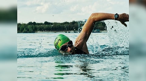 Representative Image