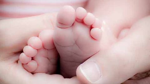 Representative image