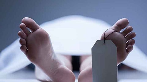 Representative image