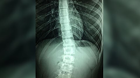 Representative Image