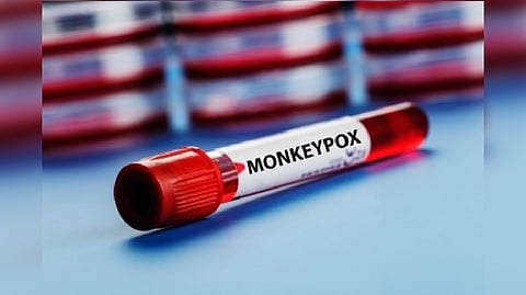 Representative image.