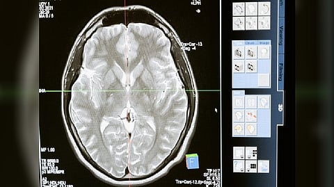 Representative Image