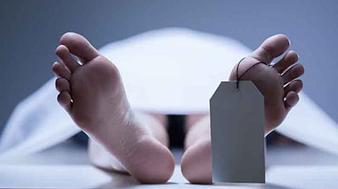 Representative image