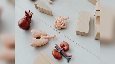 Representative image