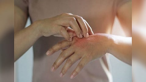 Representative Image