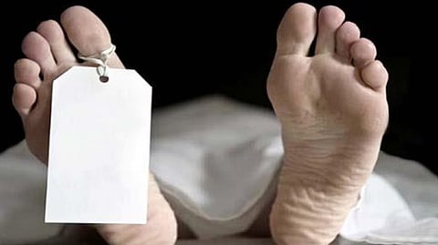 Representative image