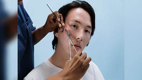 Representative Image