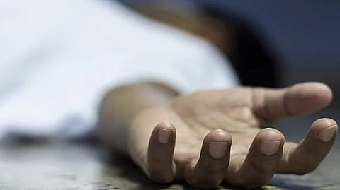 Representative image