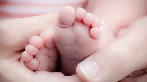 Representative image