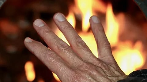 Representative image