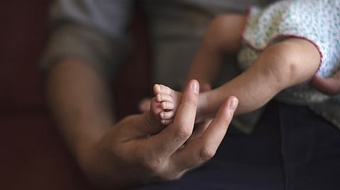 Representative image