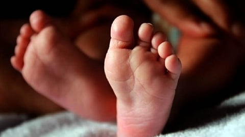 Representative image