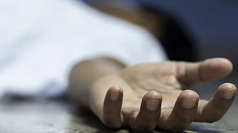 Representative image