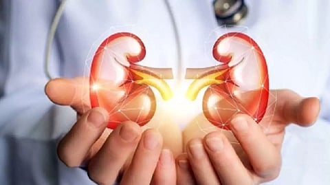 Representative image