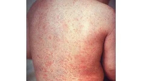 Representative Image