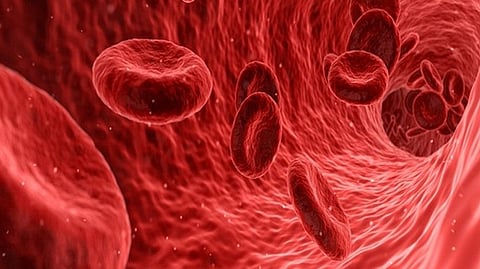 Representative Image