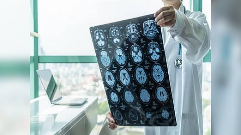 Representative Image