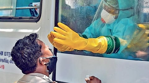 Representative image