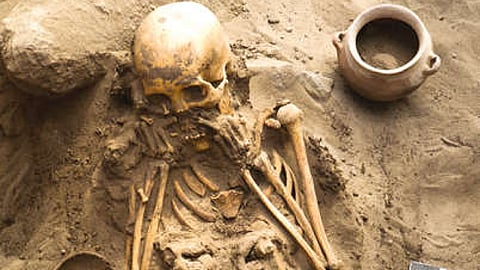 Representative Image