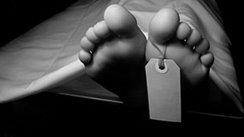 Representative image