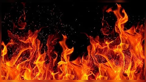 Representative Image