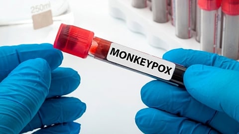 Representative image