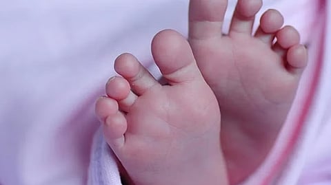 Representative image